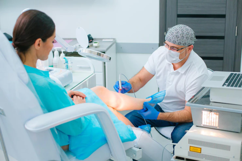 laser spider vein removal