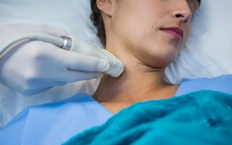 coolsculpting neck cost